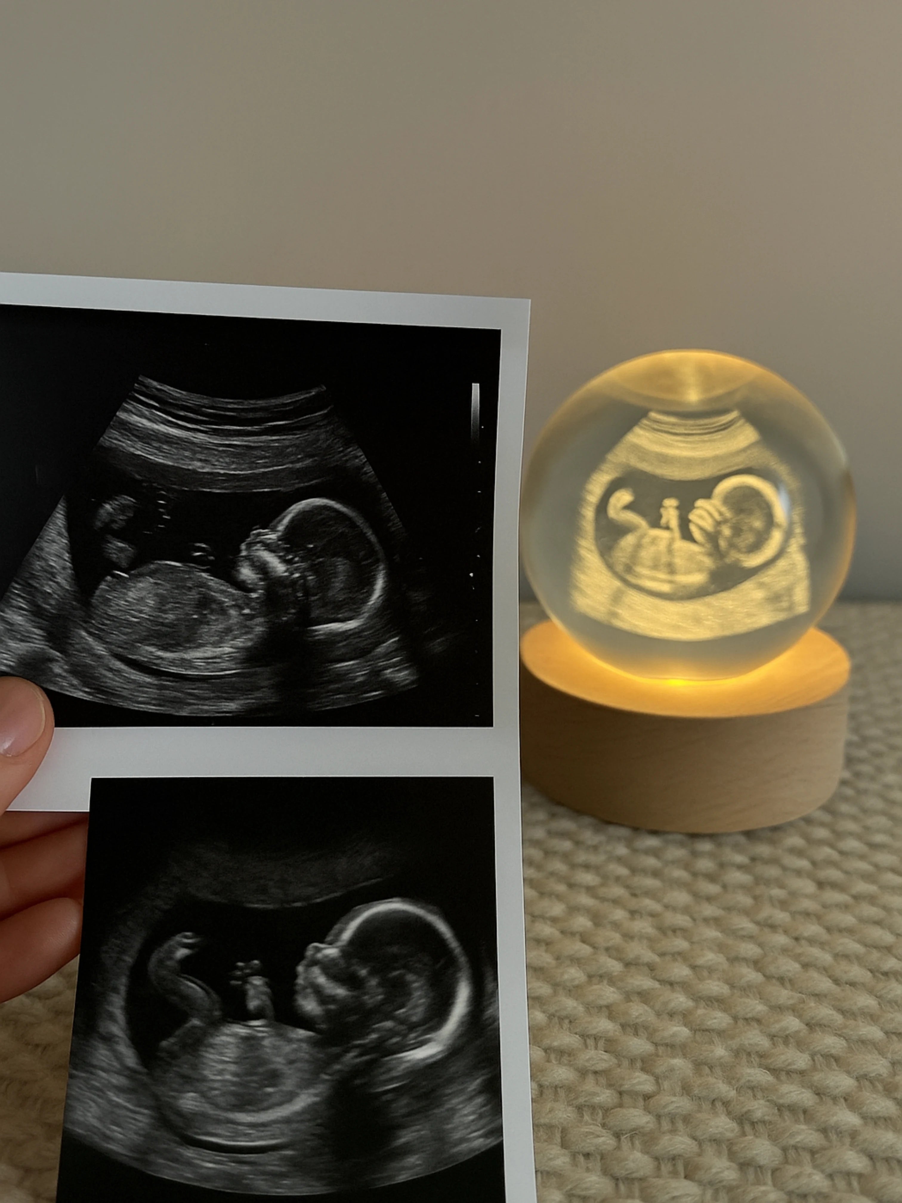 Make Your First Encounter with Your Baby Last Forever